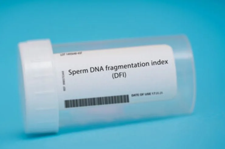 DNA Fragmentation Index (DFI)