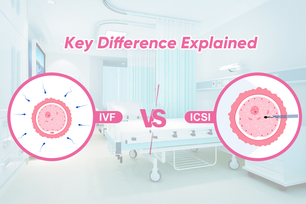 IVF vs ICSI: Which Fertility Treatment is Right for You?