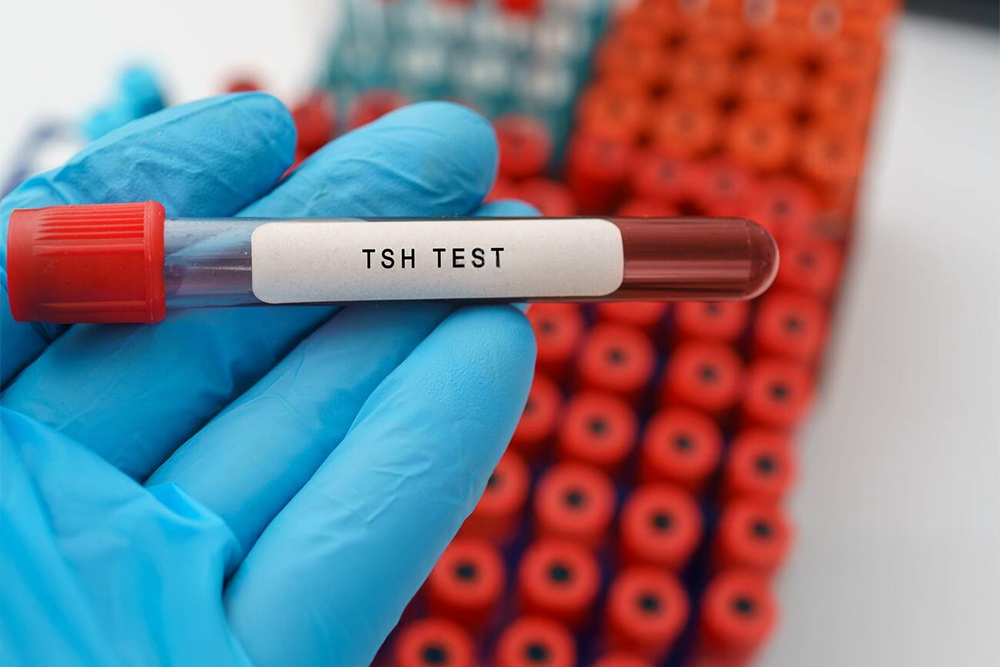 TSH Levels in Pregnancy: What’s Normal and When to Worry?
