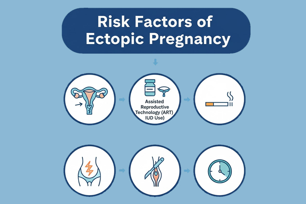 Risk Factors of Ectopic Pregnancy