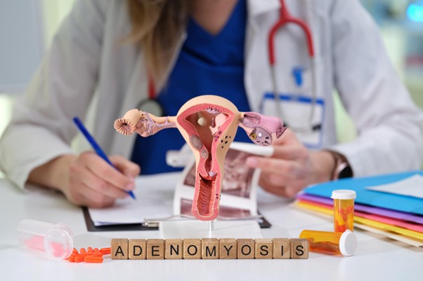 Adenomyosis and Fertility: What You Need to Know